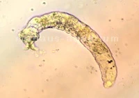 Gill worm at a disc under the microscope
