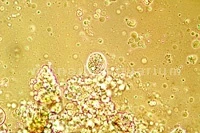 Skin-cloudy Chilodonella under the microscope