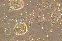 Close-up of Chilodonella